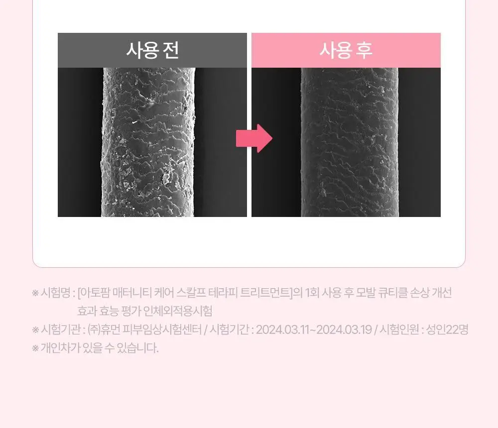 [임산부] 아토팜 매터니티 케어 스칼프 테라피 트리트먼트 220ml 상세페이지 30